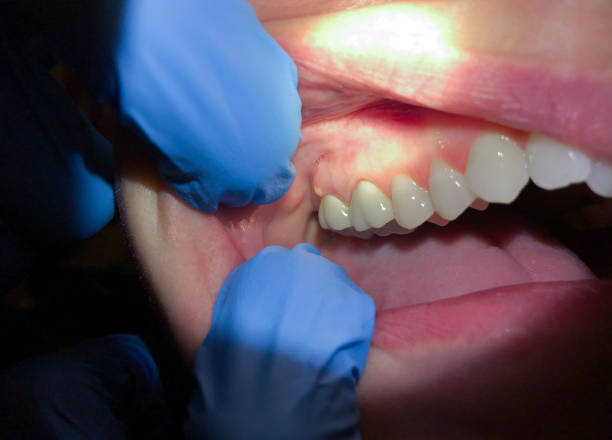 Best Pediatric Emergency Dentist in Beverly Hills, FL