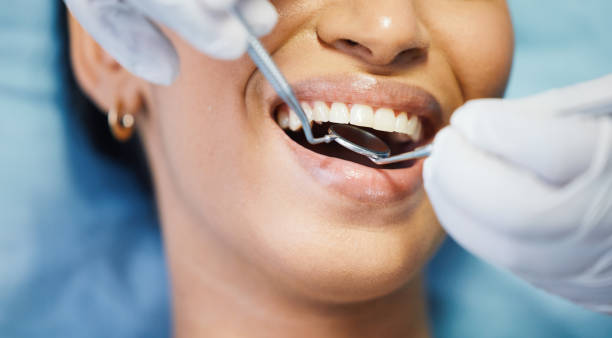 Best Emergency Dental Care for Abscessed Tooth in Beverly Hills, FL